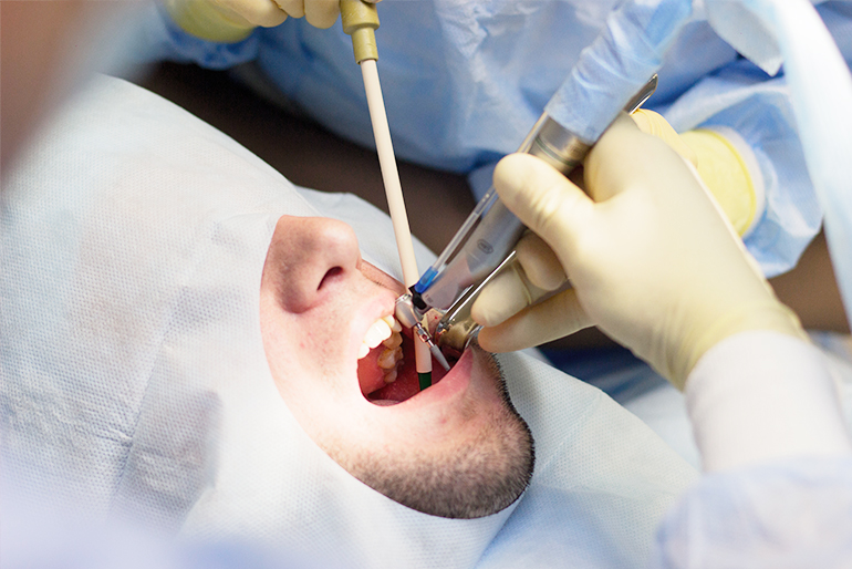Chirurgie Buccale