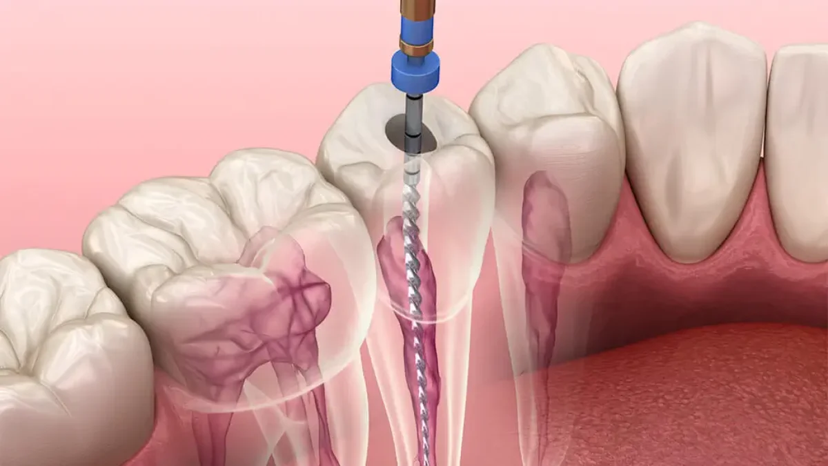 Endodontie
