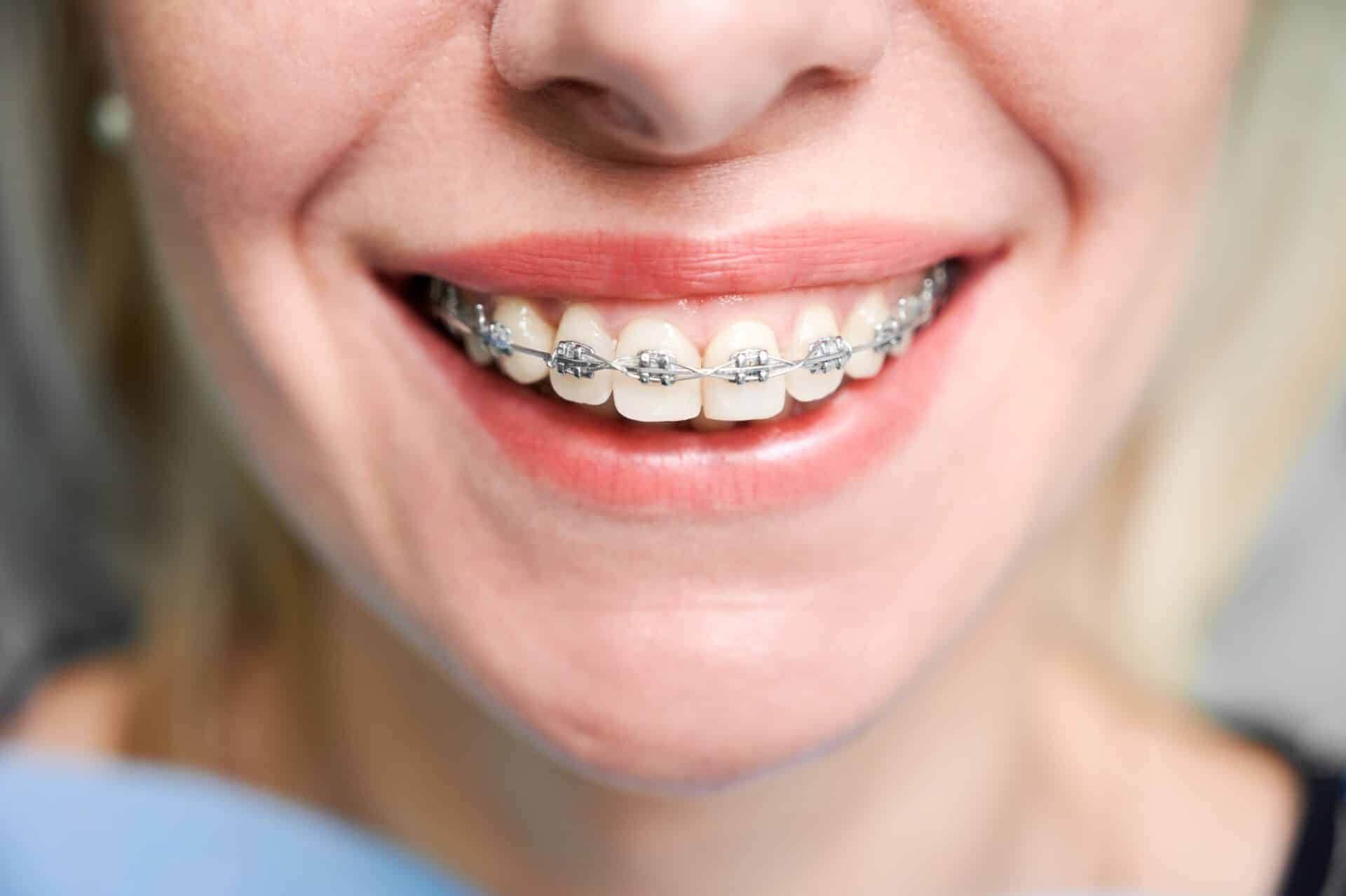 Orthodontie Pitts 21